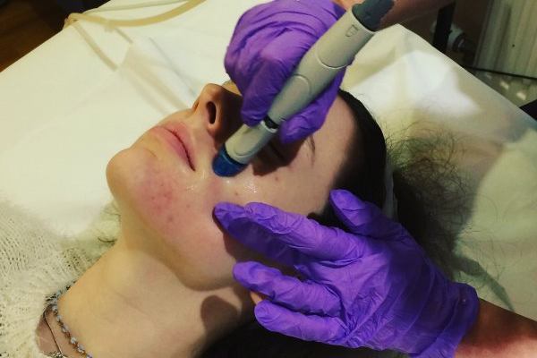 Hydrafacial